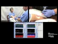 TCD BUBBLE TEST for Cardiac Shunt Detection PFO TEST Zsolt Garami MD