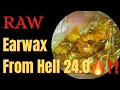 Earwax From Hell 24 0 Raw Footage