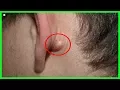 What You Need To Know About That Lump Behind Your Ear Best Home Remedies