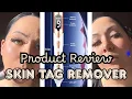 At-Home Skin Tag Remover Pen Easy Affordable Skincare Solution