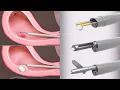 Operative hysteroscopy for polyps and fibroids TVASurg