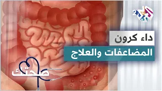 داء كرون الأسباب والمضاعفات والتشخيص والعلاجات المتوفرة 