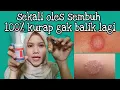 Lagu Cara Mengobati Kurap Kudis Sekali Oles Gak Akan Balik Lagi