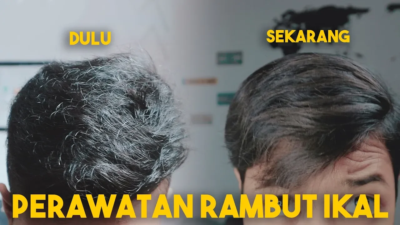 rambutikalgondrong #rambutikalkeren - Business Enquiries or Endorsement : bemoregentle.official@gmai. 