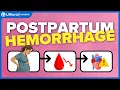 Master Postpartum Hemorrhage for NCLEX Live Concept Map