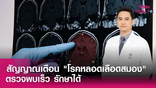 โรคหลอดเลือดสมองคืออะไร และมีกี่ประเภทหลัก ๆ