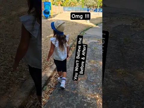 🌸 OMG !!!  You Won't Believe the Before & After! #shorts #cute #song #love
