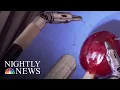 This Surgical Robot Promises A Quicker Recovery But There Are Risks NBC Nightly News