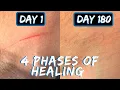 Cut Healing Over Time - 6 Months