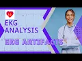 EKG Artifacts