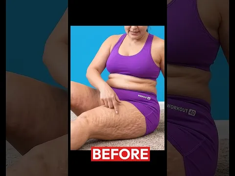 Thigh Cellulite Smooths Out When You Sit Like This