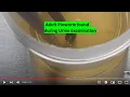 Adult Pinworm found during Urine Examination
