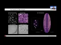 I2K 2020 tutorial Object segmentation and image restoration with StarDist and CSBDeep