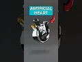 Download Lagu Engineers Create World's First Fully Artificial Heart