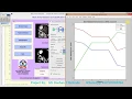 Matlab Code for Brain Tumor Detection Using Neural Network