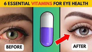 Revitalize Appearance 6 Essential Vitamins for Striking Eye Health