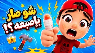شو صار لإصبع خربوط لما لعب بالشاكوش؟! 😱🔨 | أغنية خربوط والشاكوش | حبيبي بيبي