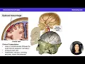 Intracranial Hemorrhage Overview | Epidural, Subdural, Subarachnoid & Intracerebral hemorrhage