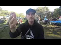 I Woke Up Paralyzed 7 Weeks of Struggles Later Health Update