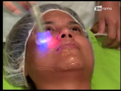 Tratamiento de radiofrecuencia facial