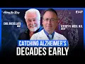 Jeffrey N Weiss M D The Four-Cent Test That Could Catch Alzheimer s Decades Early