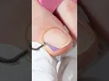 Acrylic powder thumb nail repair