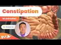 Constipation The GutDr Explains 3D Gut Animation