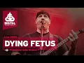 Download Lagu Brutal Assault 26 - Dying Fetus (live) 2023