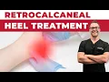 Download Lagu Back Of Heel Pain Fixed Fast [Retrocalcaneal Bursitis Relief]