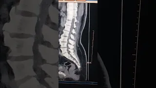 الدكتور المعالج بيرسل المريض يعمل اشعه لانه بيبقي عنده سؤال وعايز اجابه شاهد الفيديو CT MR 