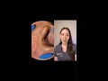 Large blackhead on the ear