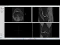 Mastering ITK-SNAP Session Manual Segmentation of MRIs