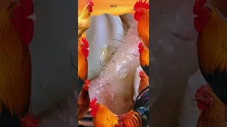 Blackheads Removal Acne Treatment and Very Satisfying Satisfying Pimple pop