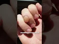 Download Lagu Apakah Kita Seharusnya Pecahin Gelembung 'Kapalan' Atau Lebih Baik Jangan? 🤔🤔