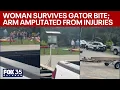 Woman survives alligator bite in Marion County Silver River arm amputated family says