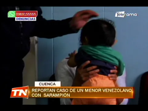 Reportan caso de un menor venezolano con sarampión
