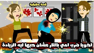 اخويا ضرب امي بالنار عشان حبها الزيادة فيه قصة حقيقية 
