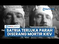 Download Lagu Eks TNI AL Satria Kumbara Terluka Parah Dihantam Mortir \u0026 Dikepung Ukraina, Minta Doa Rakyat RI