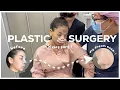 I GOT A NOSE JOB IN KOREA plastic surgery vlog INDO SUB Erna Limdaugh