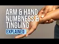 Download Lagu Arm and Hand Numbness and Tingling Explained