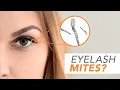 What are Demodex Mites Optometrist Explains