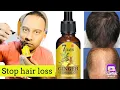 You Want Your Hair Back Use 7 DAYS GINGER germinal hair OIL with DERMA ROLLER