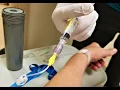 Radiopharmaceutical therapy CPT code - simplify medical coding