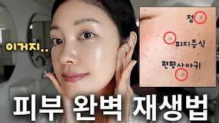 ‘극강의 재생관리법’✨ 점, 편평사마귀 등 제거한 분들 ‘이 루틴’ 필수! (색소침착, 흉터 개선) | 유나 UNA