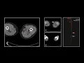 CTA Extremity Pt 1 Free Radiology CME