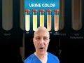 Download Lagu Minum Air yang Cukup? Perhatikan Air Kencing Anda! Dr. Mandell