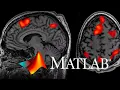 Basics of NifTI file visualization on MATLAB