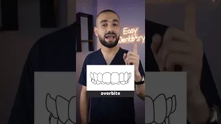 ٥ اشكال للاسنان تحتاج لتقويم الاسنان انت منهم 