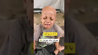انا جوعان يا الله جوعان حال اطفالنا في غز  ة دندنها