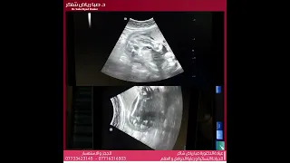 جدول الولد على يد الدكتورة صبا رياض شاكر 